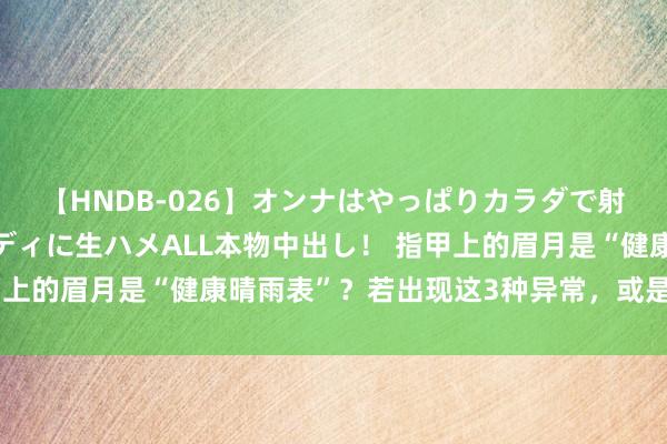 【HNDB-026】オンナはやっぱりカラダで射精する 厳選美巨乳ボディに生ハメALL本物中出し！ 指甲上的眉月是“健康晴雨表”？若出现这3种异常，或是疾病信号